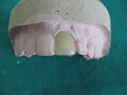 Ceramic laminate fabrication stage 2